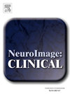 Neuroimage-clinical期刊封面